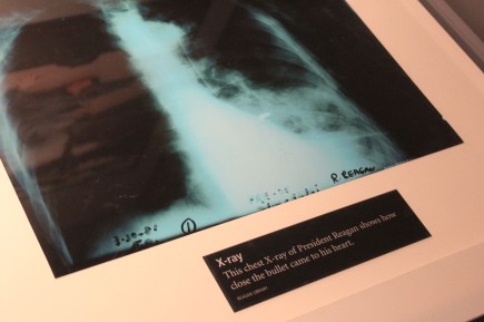 And an exray showing how close the bukllet was to his heart. I had no idea it was that close